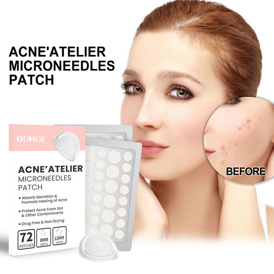 OUHOE ClearSkin – Acne Patches with Microneedles (72 pcs)